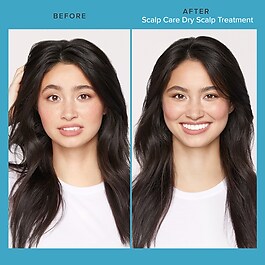 Scalp Care - Dry Scalp Treatment